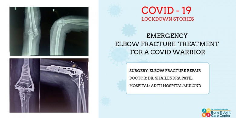 Elbow Fracture Treatment By Joint Replacement surgeon in Mulund