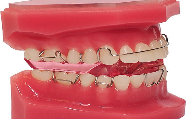 orthodontist treatment