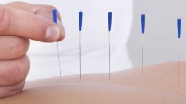 Vestibular Rehab Service in Ottawa | Vestibular Rehabilitation Service in Ottawa