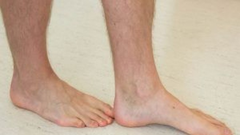 Vestibular Rehabilitation Service in Ottawa | Vestibular Rehab Service in Ottawa