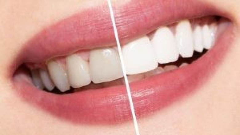 Emiles Dental Care