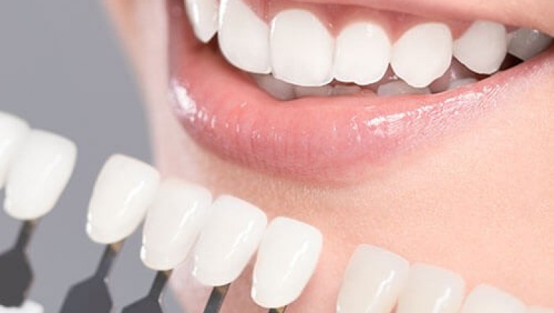 Thornhill Square Dentistry