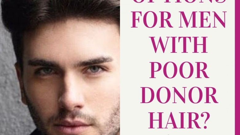 Options For Men With Poor Donor Hair?
