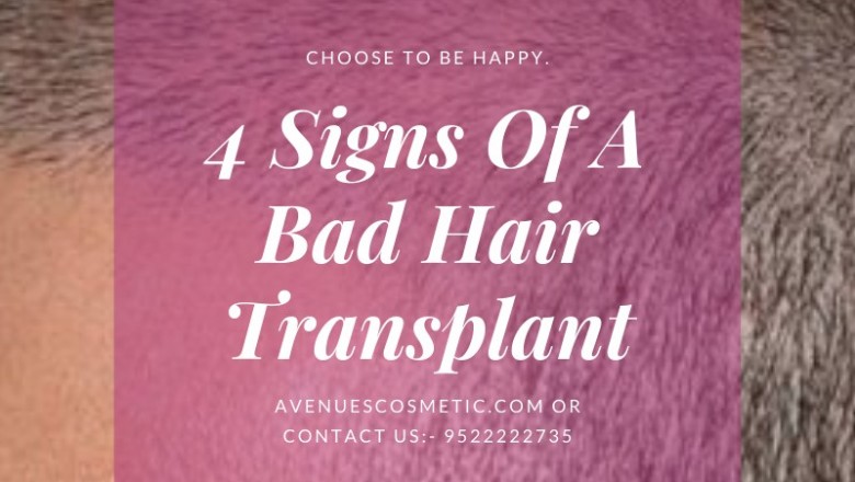 4 Signs Of A Bad Hair Transplant