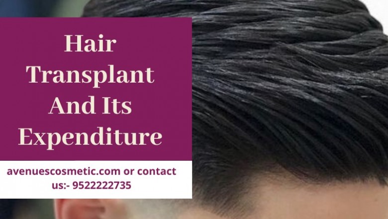 How The Cost Of A Hair Transplant Process Is Decided