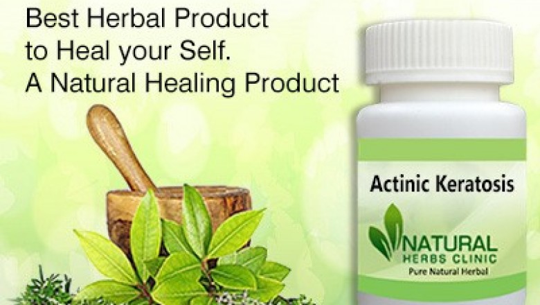  Herbal Treatment for Actinic Keratosis - Natural Herbs Clinic