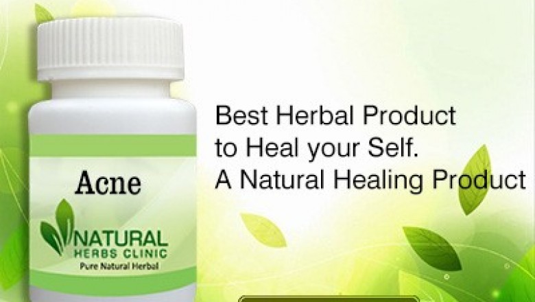  Herbal Treatment for Acne - Natural Herbs Clinic