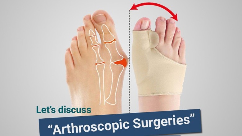 Best Knee Replacement Surgery in Delhi NCR, Total Knee surgeon