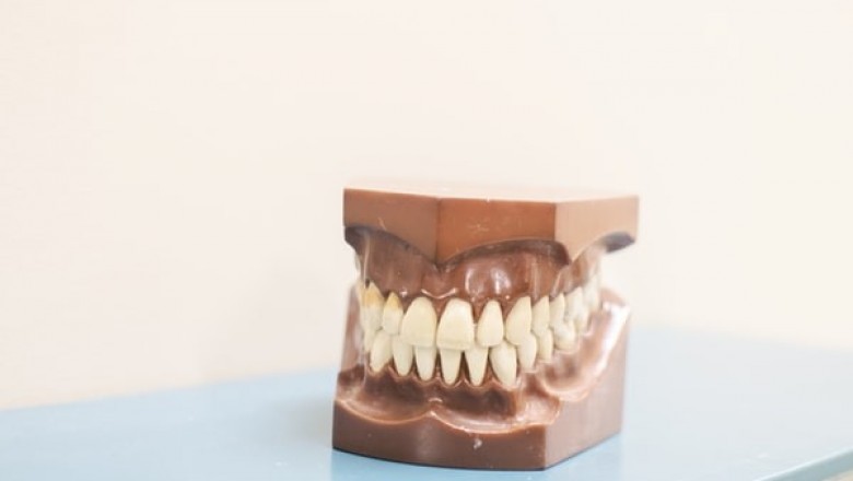 How Dental Veneers Help People Feel Better About Themselves?