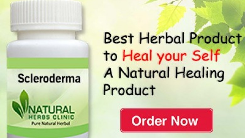 Herbal Treatment for Scleroderma - Natural Herbs Clinic