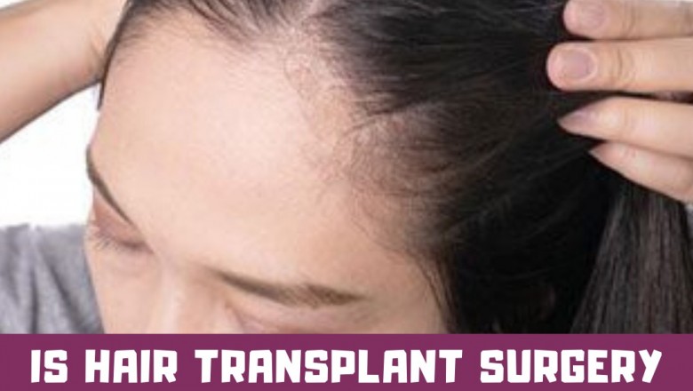 Is Hair Transplant Surgery Effective For Very Young Men With Advanced Hair Loss?