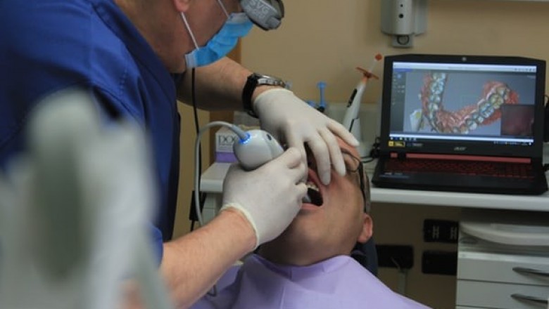 Why Is It Better to Visit a Dentist Regularly Than Using Dental Veneers?