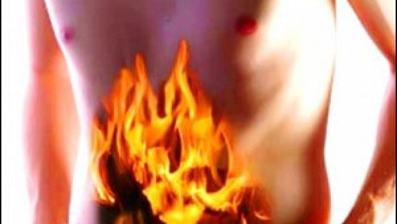 Herbal Remedies for Acidity