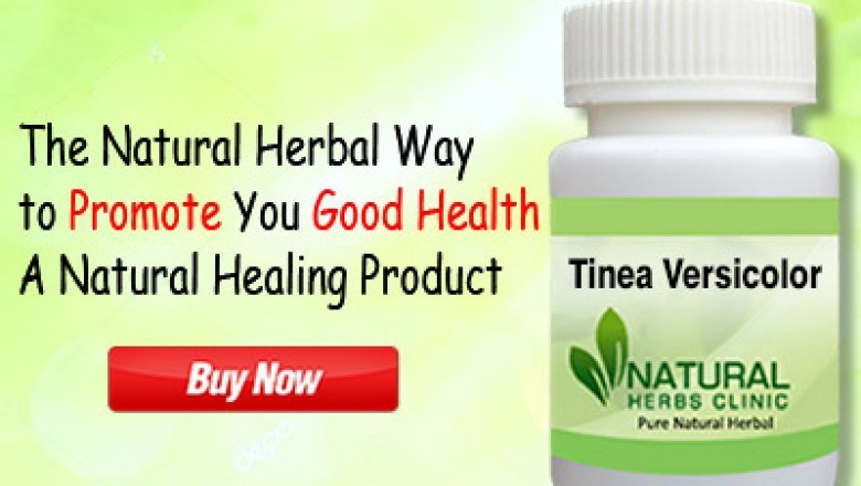 Natural Remedies for Tinea Versicolor, Symptom and Causes
