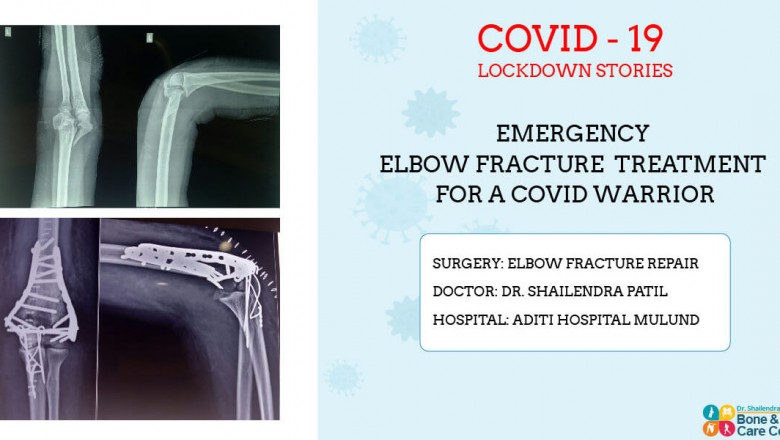 Elbow Fracture Treatment By Joint Replacement surgeon in Mulund