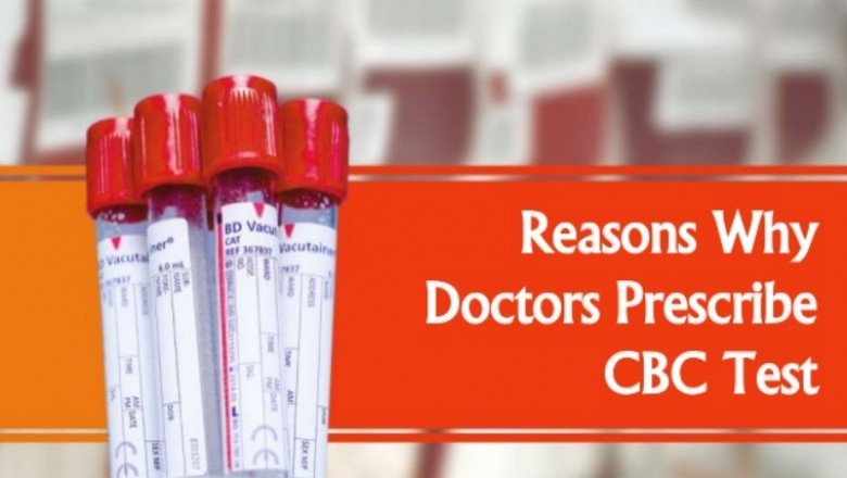 Reasons Why Doctors Prescribe CBC Test