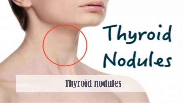A Brief About Thyroid Nodules