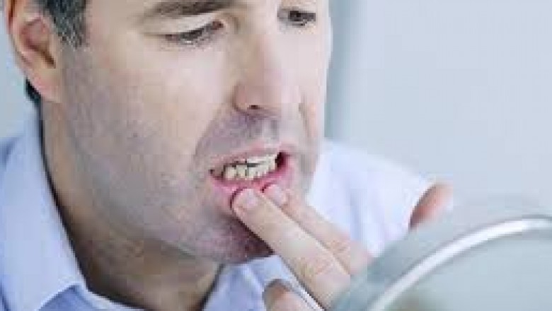 Gum Problem in Blue Mountain