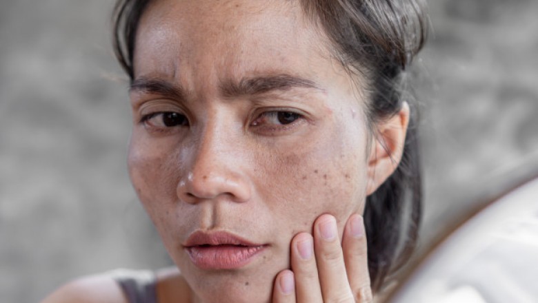 How to Smooth Skin Texture on Face and Wrinkles