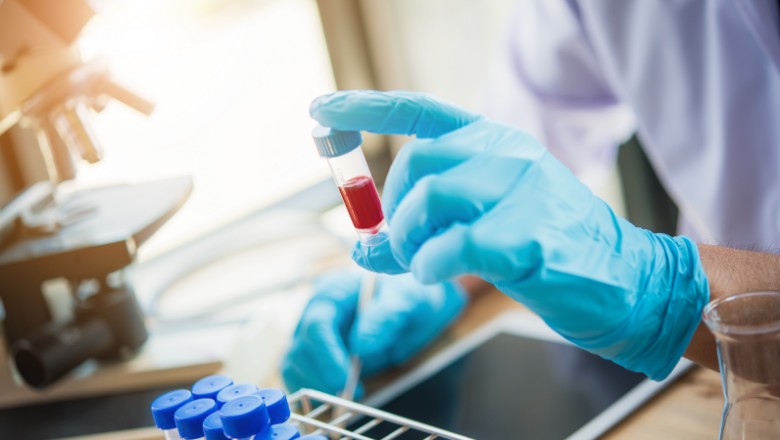 Common Blood Tests That Are Used to Diagnose Cancer