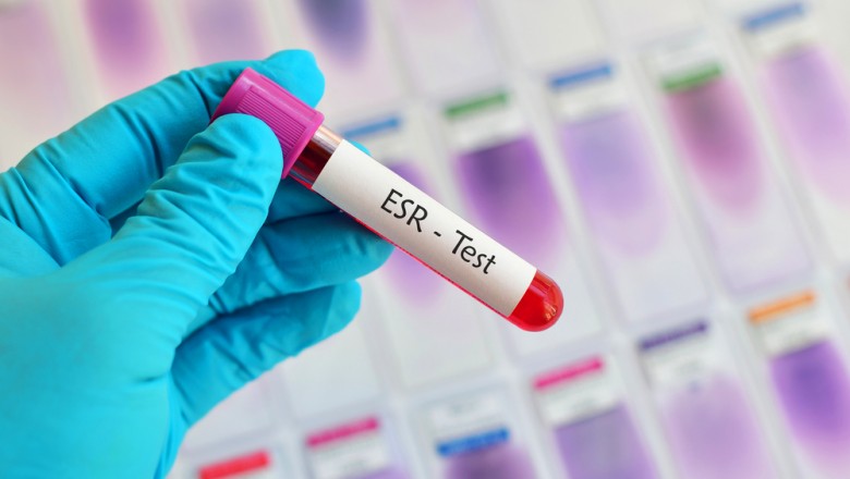 What is ESR in Blood Test ?