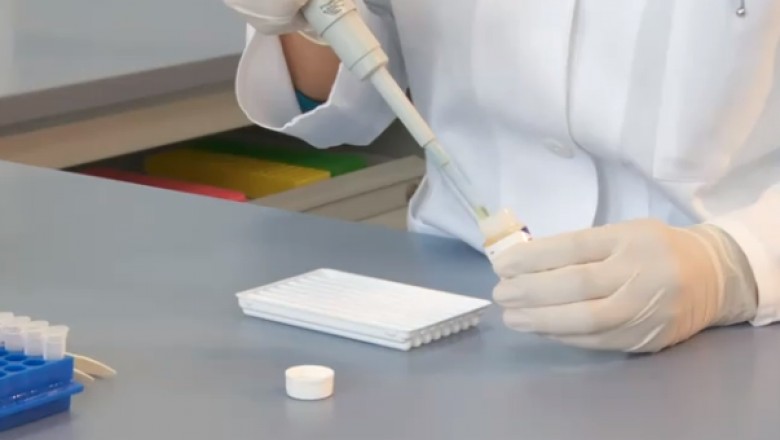 What is the SGPT Test?
