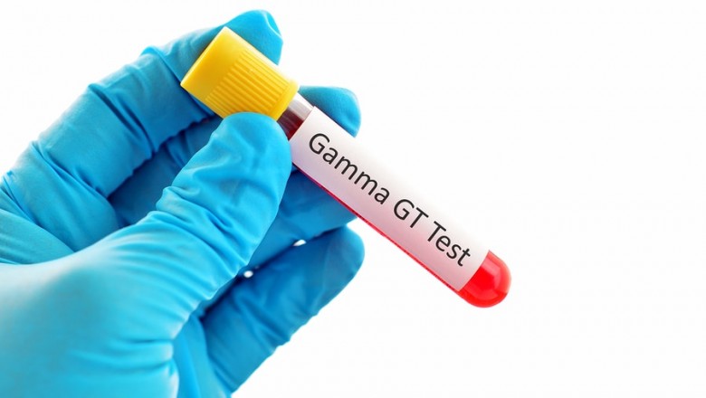 Understanding Gamma-Glutamyl Transferase (GGT) Test