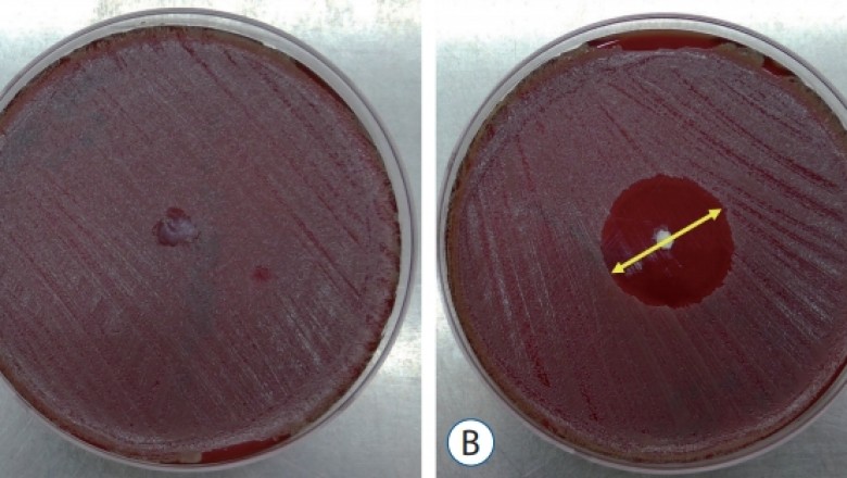 Some Noteworthy Points About Vancomycin Test