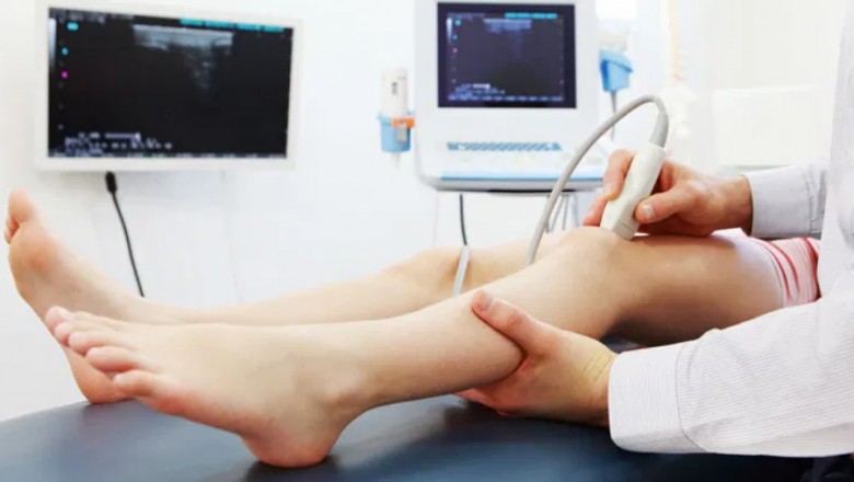 Everything to Know About a Colour Doppler Test