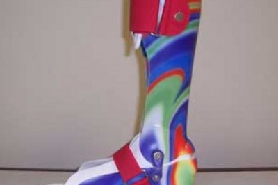 Prosthesis Alexandria