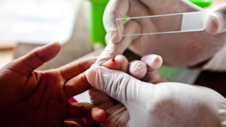 Why is it Important to Get Malaria Tested from a Good Lab?
