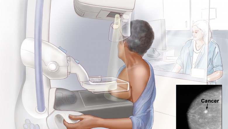 Learn more about Mammography Test
