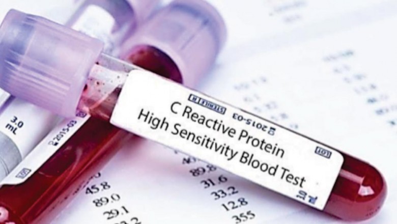 Know about C-reactive Protein Test
