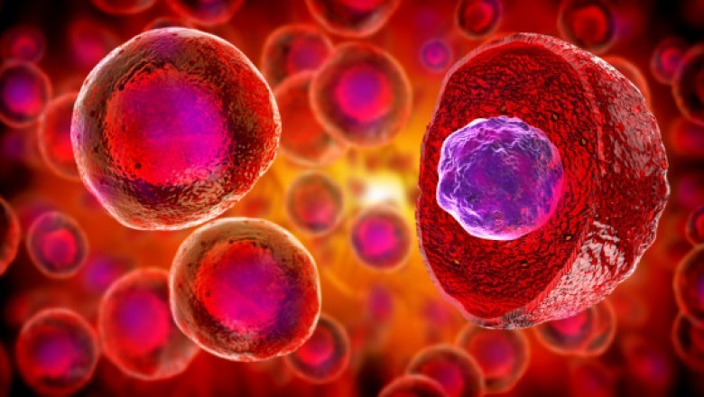 Stem Cell Treatment