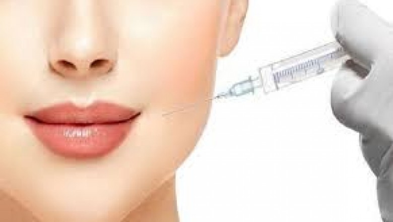 US Hyaluronic Acid-Based Dermal Fillers Market Trends, Size, Forecast - 2019-2025