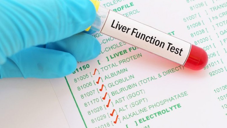 Learn more about LFT test