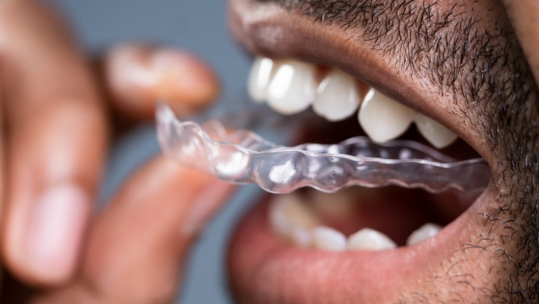 Teeth Grinding : Are You Harming Your Teeth?