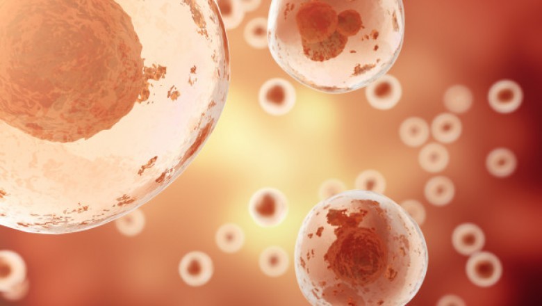 Stem Cell Banking -stem cell