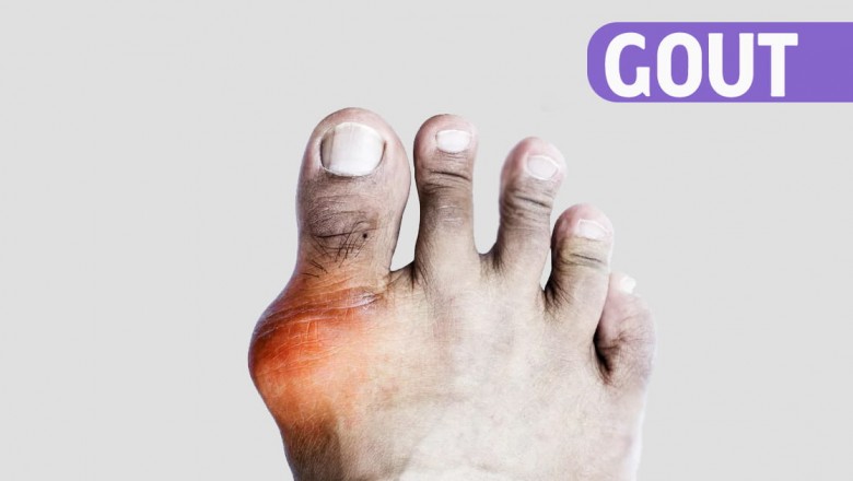 GOUT Specialist in Bhubaneswar, Odisha- Dr. Pradeepta Sekhar Patro