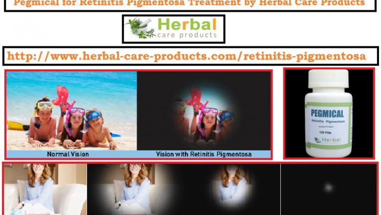 10 Natural Remedies for Retinitis Pigmentosa