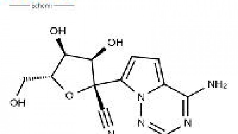 Safety thoughts in chemical plants