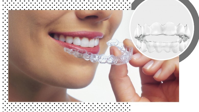 Find Invisalign Braces for Teeth in Hamilton