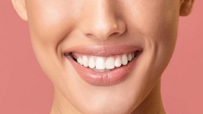 Teeth Whitening Options for You