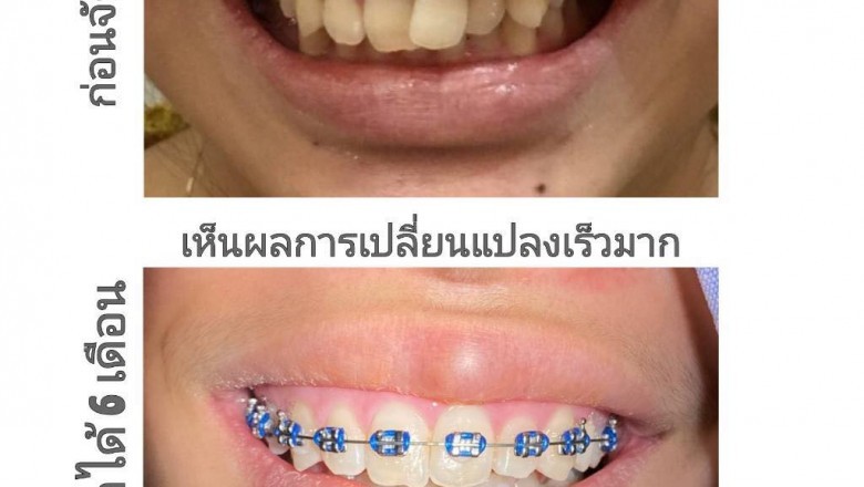 The Need to have For an Orthodontic Specialist