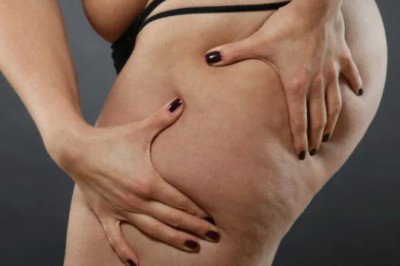 Know The Procedure To Remove Fat