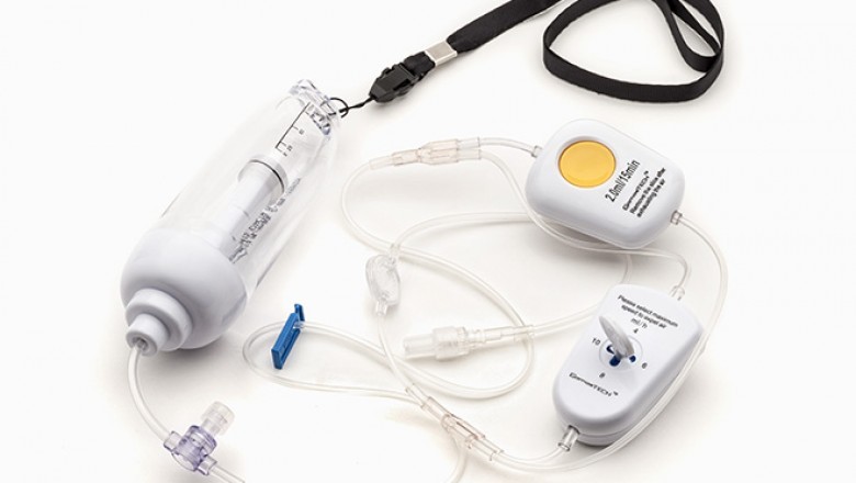 Elastomeric Infusion Pumps are gaining Massive Popularity in Medical Field with Applications