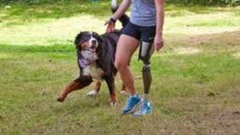 Prosthesis Leesburg VA