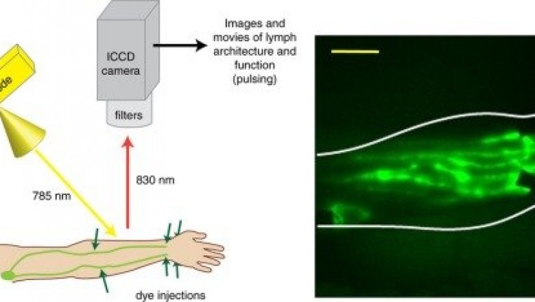 Near Infrared Imaging Market Research Analysis Report 2021 to 2030 - CAGR 14.1%