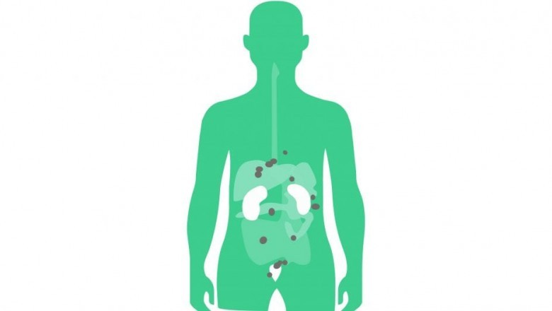 Theranostics, a change from conventional medicine to a new approach to personalized and precision medicine