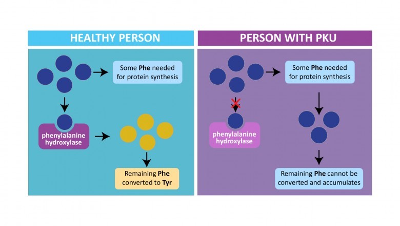 Many Studies Show that Dietary Modification is the Most Efficient and Appropriate Treatment choice for Phenylketonuria.
